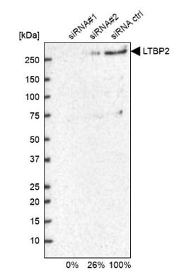 Latent TGF-beta bp2/LTBP-2 Antibody, Novus Biologicals 25 &mu;L; Unlabeled:Antibodies,